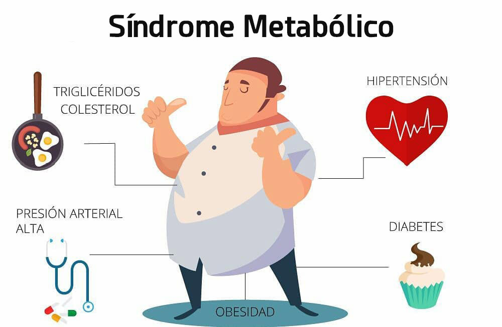Síndrome metabólico y ejercicio físico